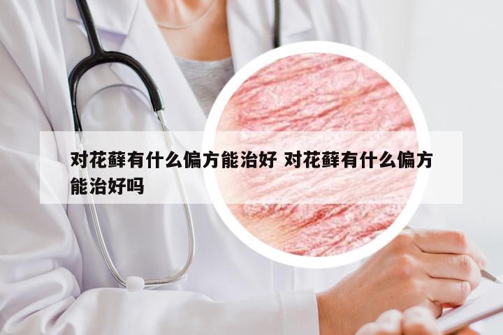 对花藓有什么偏方能治好 对花藓有什么偏方能治好吗