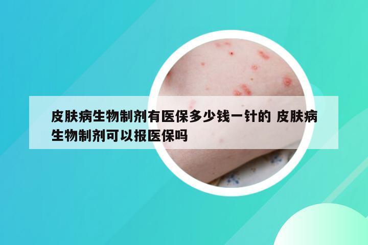 皮肤病生物制剂有医保多少钱一针的 皮肤病生物制剂可以报医保吗