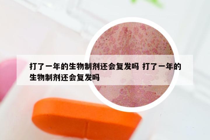 打了一年的生物制剂还会复发吗 打了一年的生物制剂还会复发吗