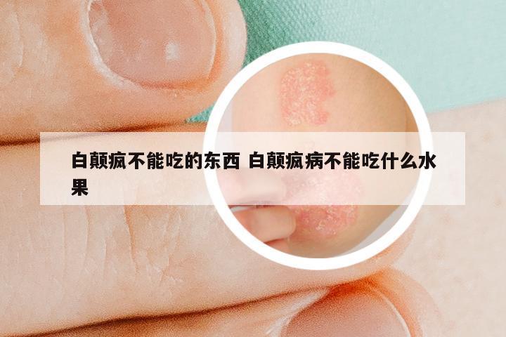 白颠疯不能吃的东西 白颠疯病不能吃什么水果