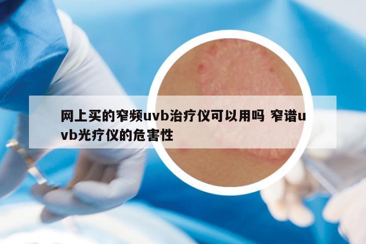 网上买的窄频uvb治疗仪可以用吗 窄谱uvb光疗仪的危害性