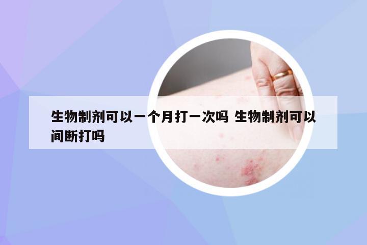 生物制剂可以一个月打一次吗 生物制剂可以间断打吗