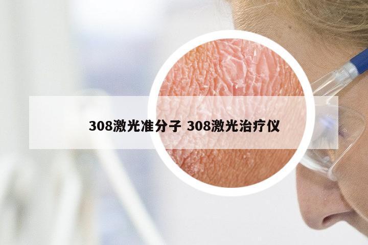 308激光准分子 308激光治疗仪