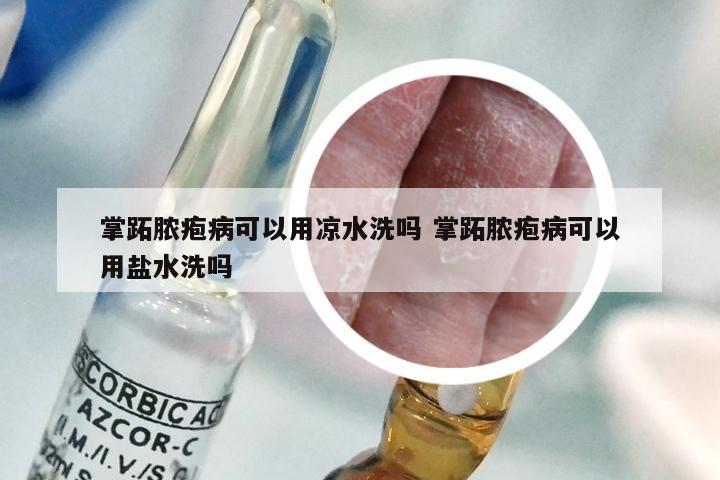 掌跖脓疱病可以用凉水洗吗 掌跖脓疱病可以用盐水洗吗