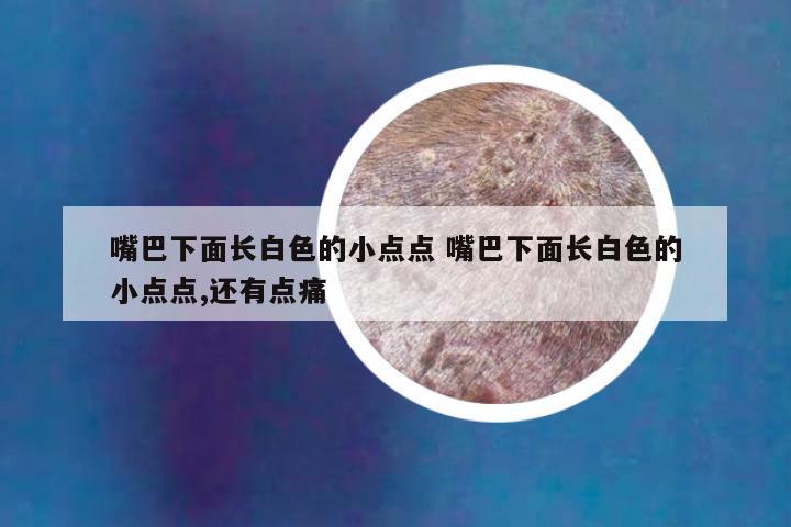 嘴巴下面长白色的小点点 嘴巴下面长白色的小点点,还有点痛