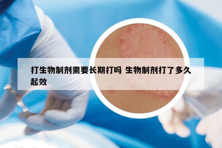 打生物制剂需要长期打吗 生物制剂打了多久起效