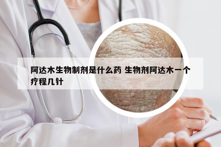 阿达木生物制剂是什么药 生物剂阿达木一个疗程几针