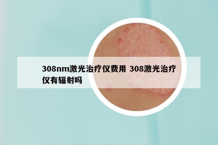 308nm激光治疗仪费用 308激光治疗仪有辐射吗