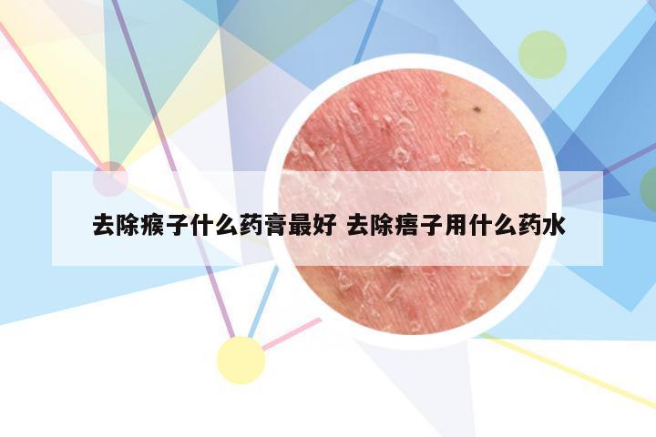 去除瘊子什么药膏最好 去除痦子用什么药水