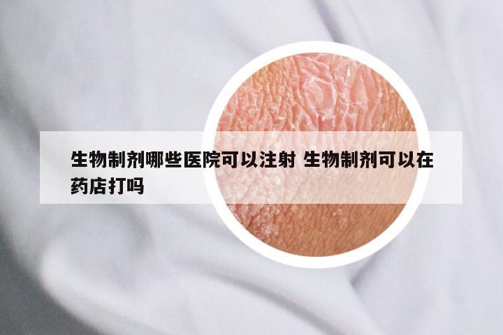 生物制剂哪些医院可以注射 生物制剂可以在药店打吗