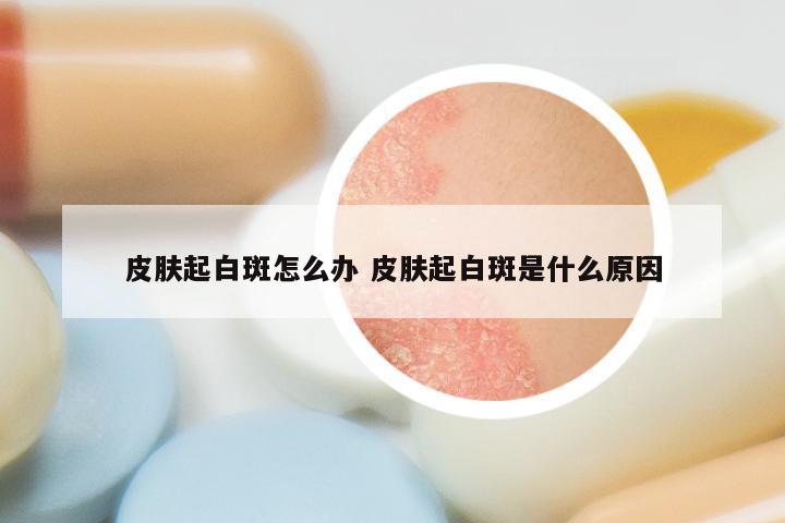 皮肤起白斑怎么办 皮肤起白斑是什么原因