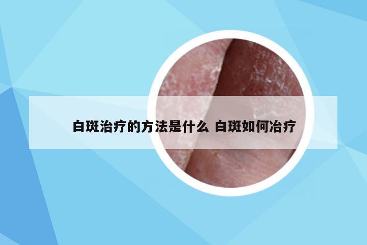 白斑治疗的方法是什么 白斑如何冶疗