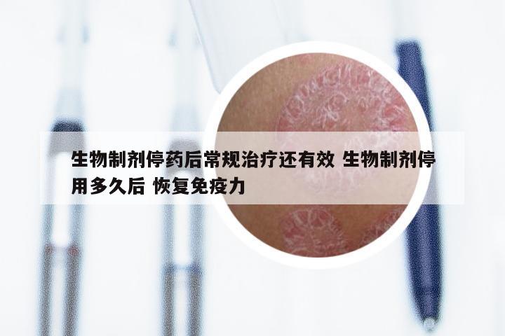 生物制剂停药后常规治疗还有效 生物制剂停用多久后 恢复免疫力