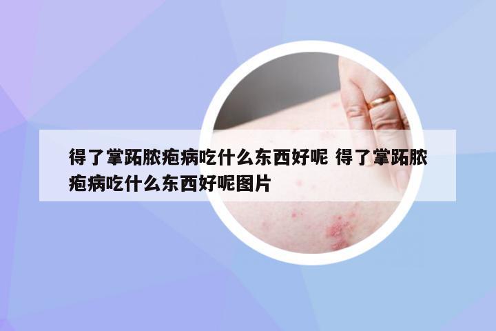 得了掌跖脓疱病吃什么东西好呢 得了掌跖脓疱病吃什么东西好呢图片