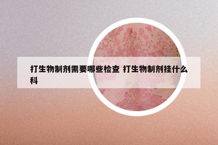 打生物制剂需要哪些检查 打生物制剂挂什么科