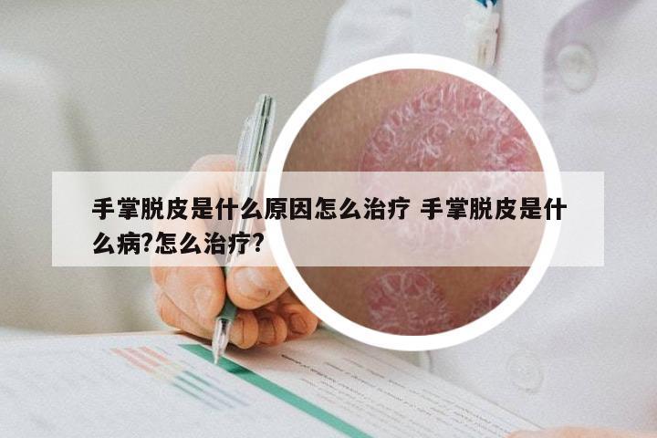 手掌脱皮是什么原因怎么治疗 手掌脱皮是什么病?怎么治疗?