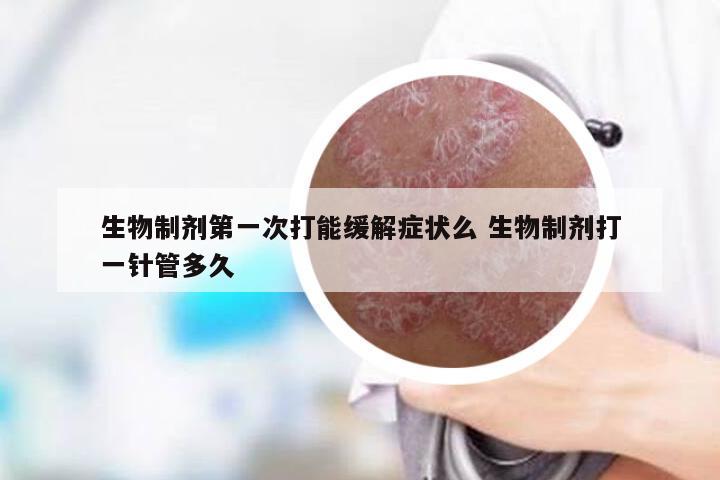 生物制剂第一次打能缓解症状么 生物制剂打一针管多久