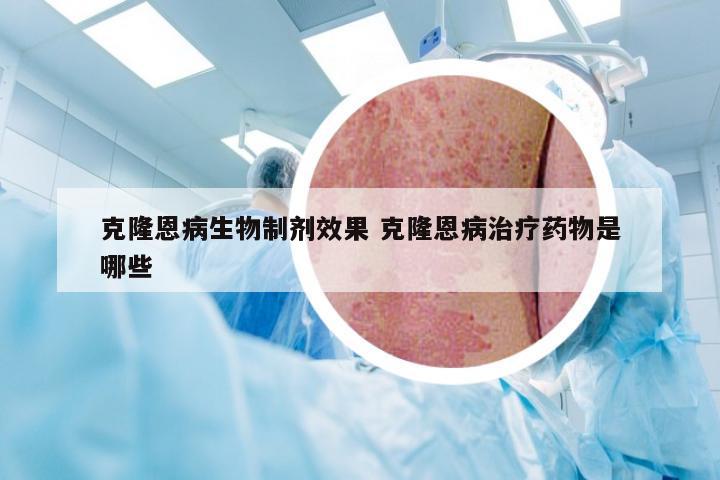 克隆恩病生物制剂效果 克隆恩病治疗药物是哪些