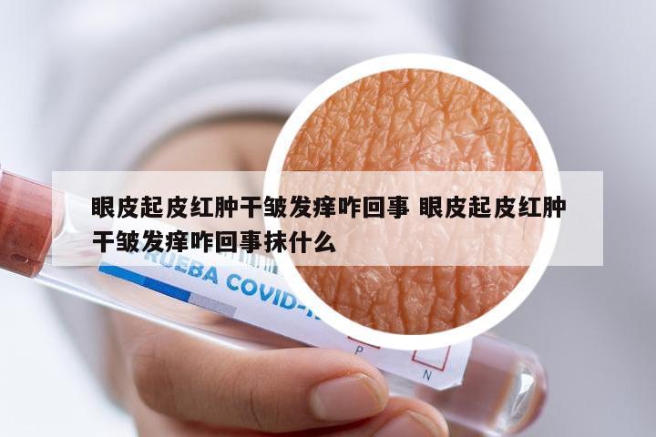 眼皮起皮红肿干皱发痒咋回事 眼皮起皮红肿干皱发痒咋回事抹什么