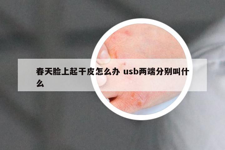 春天脸上起干皮怎么办 usb两端分别叫什么