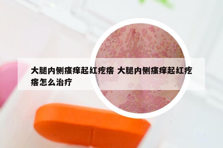 大腿内侧瘙痒起红疙瘩 大腿内侧瘙痒起红疙瘩怎么治疗