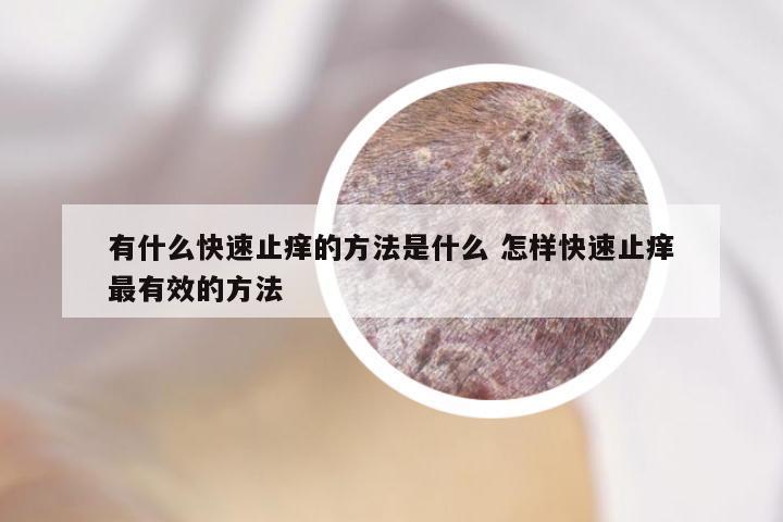 有什么快速止痒的方法是什么 怎样快速止痒最有效的方法