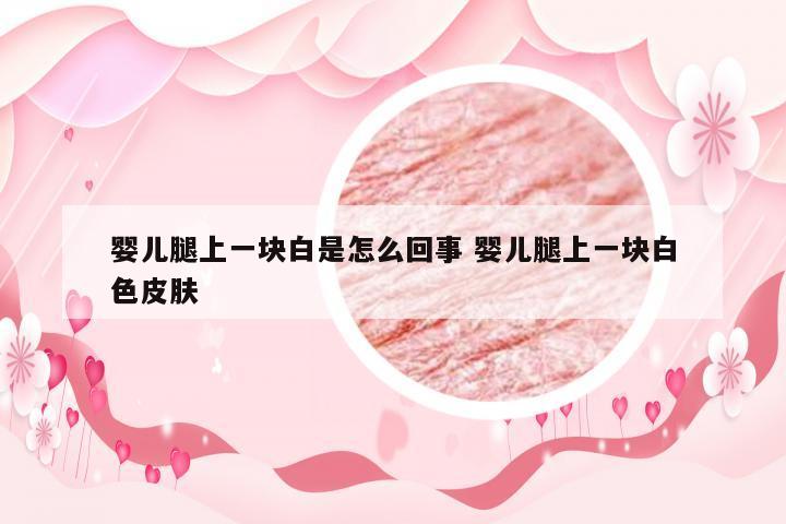 婴儿腿上一块白是怎么回事 婴儿腿上一块白色皮肤