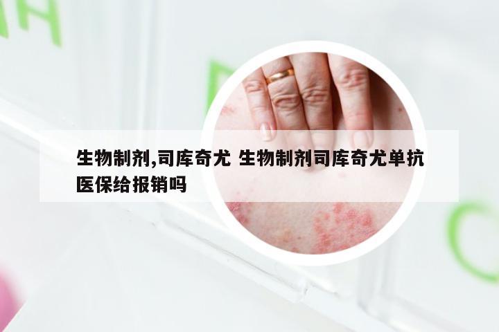 生物制剂,司库奇尤 生物制剂司库奇尤单抗医保给报销吗