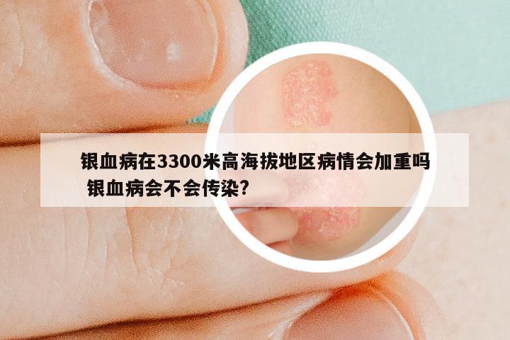 银血病在3300米高海拔地区病情会加重吗 银血病会不会传染?