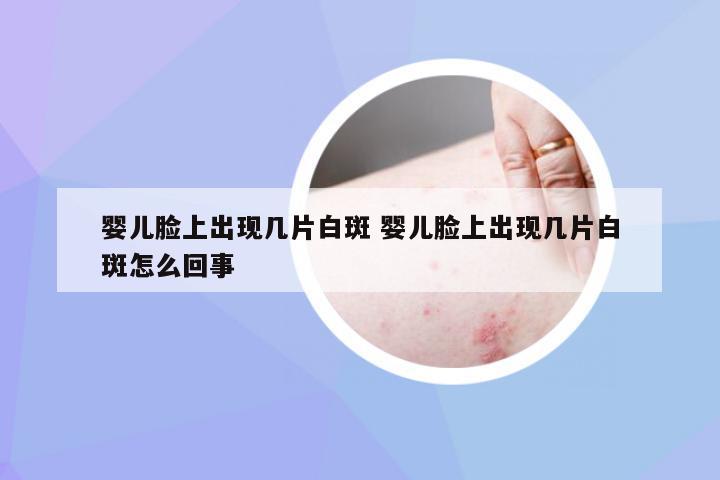 婴儿脸上出现几片白斑 婴儿脸上出现几片白斑怎么回事