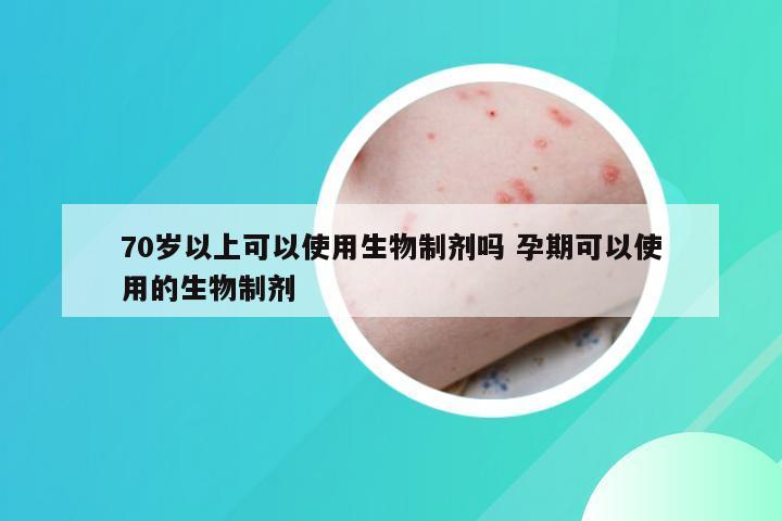 70岁以上可以使用生物制剂吗 孕期可以使用的生物制剂