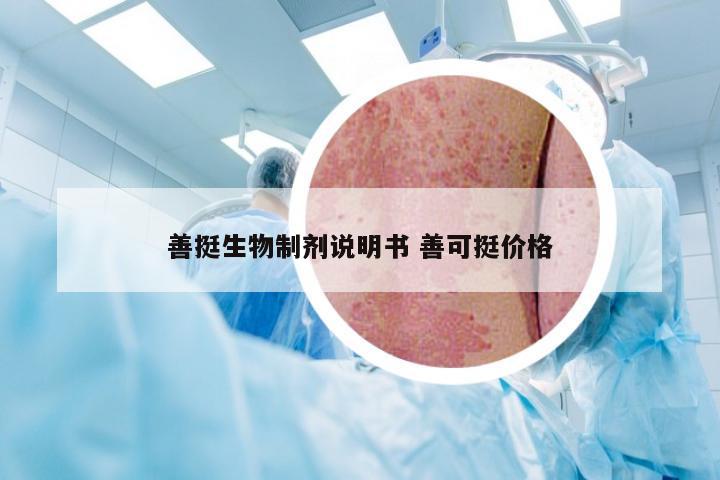 善挺生物制剂说明书 善可挺价格