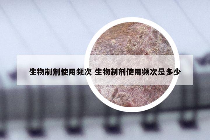 生物制剂使用频次 生物制剂使用频次是多少