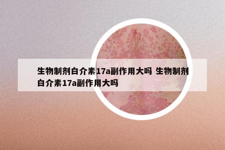 生物制剂白介素17a副作用大吗 生物制剂白介素17a副作用大吗