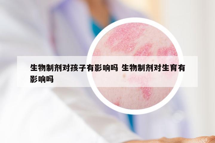 生物制剂对孩子有影响吗 生物制剂对生育有影响吗