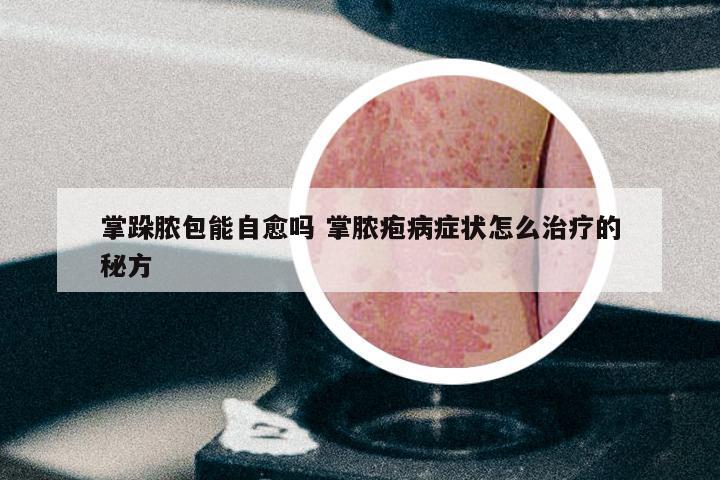 掌跺脓包能自愈吗 掌脓疱病症状怎么治疗的秘方