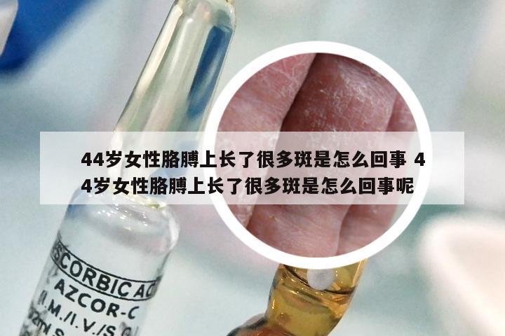 44岁女性胳膊上长了很多斑是怎么回事 44岁女性胳膊上长了很多斑是怎么回事呢