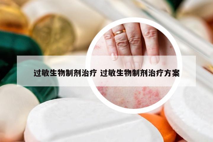 过敏生物制剂治疗 过敏生物制剂治疗方案