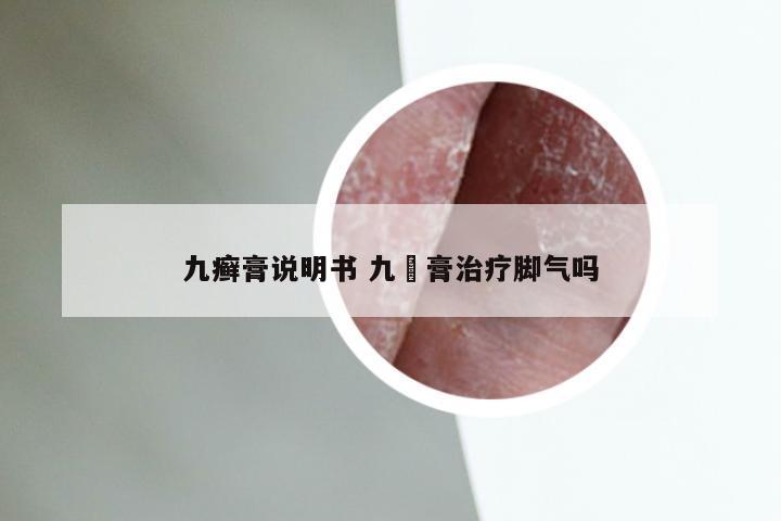 九癣膏说明书 九瑇膏治疗脚气吗