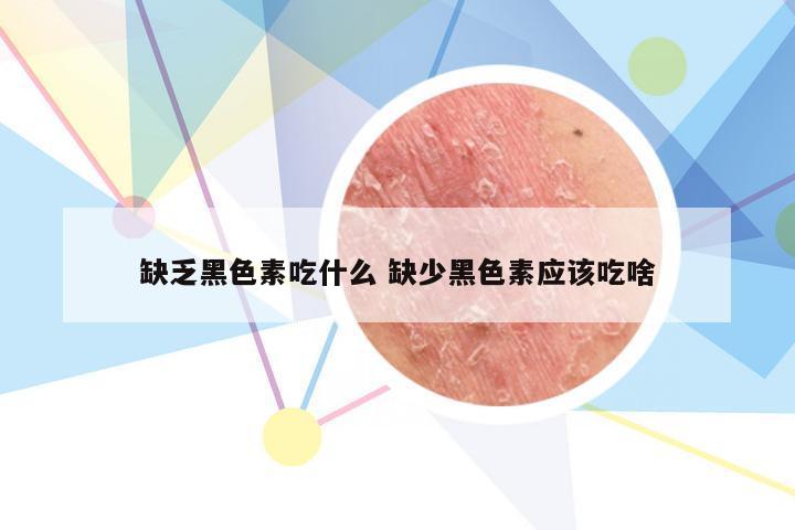 缺乏黑色素吃什么 缺少黑色素应该吃啥