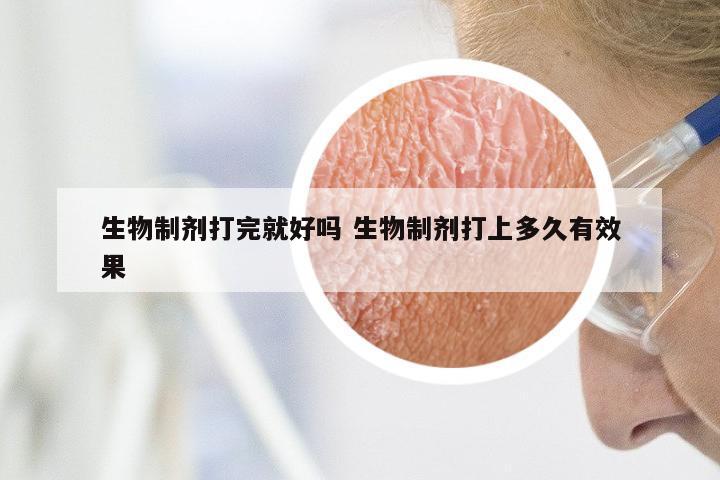 生物制剂打完就好吗 生物制剂打上多久有效果