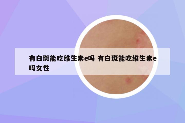 有白斑能吃维生素e吗 有白斑能吃维生素e吗女性