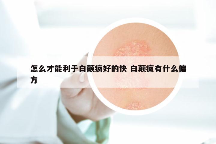 怎么才能利于白颠疯好的快 白颠疯有什么偏方