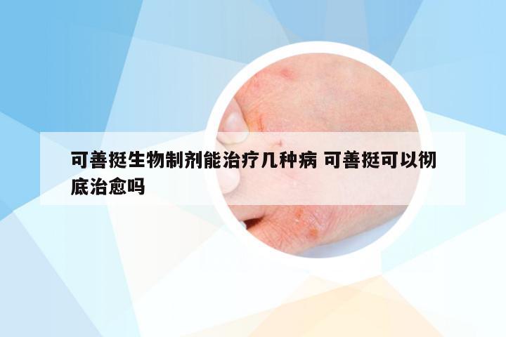 可善挺生物制剂能治疗几种病 可善挺可以彻底治愈吗