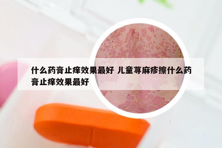 什么药膏止痒效果最好 儿童荨麻疹擦什么药膏止痒效果最好