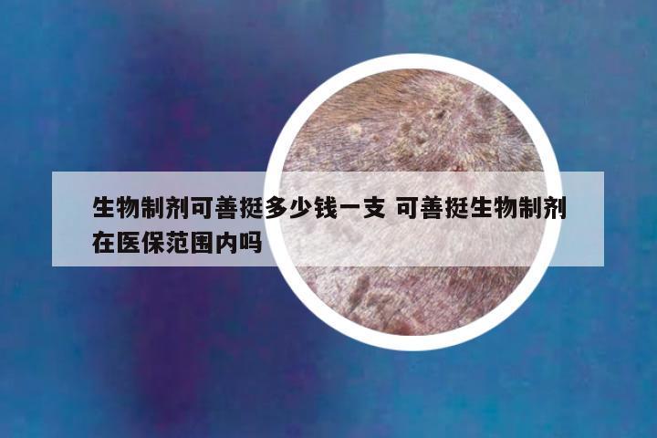 生物制剂可善挺多少钱一支 可善挺生物制剂在医保范围内吗