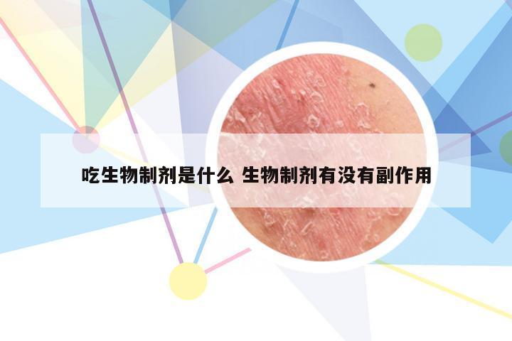 吃生物制剂是什么 生物制剂有没有副作用