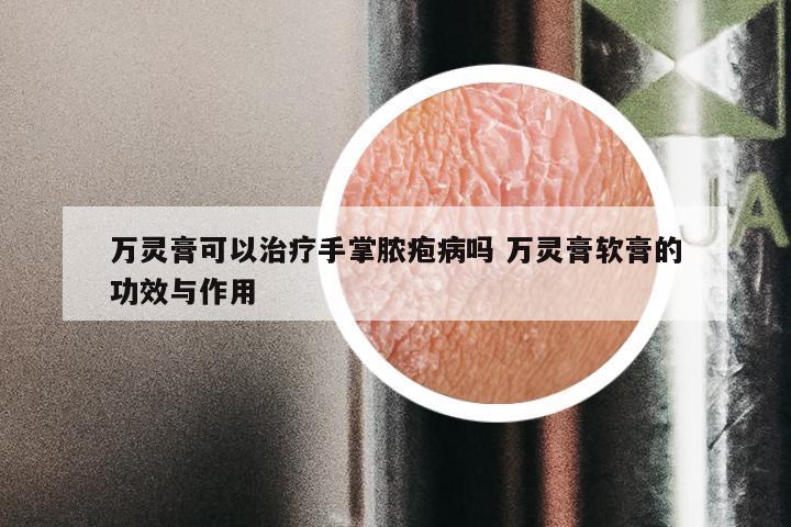 万灵膏可以治疗手掌脓疱病吗 万灵膏软膏的功效与作用