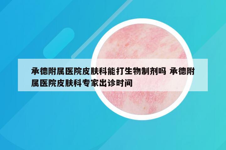 承德附属医院皮肤科能打生物制剂吗 承德附属医院皮肤科专家出诊时间