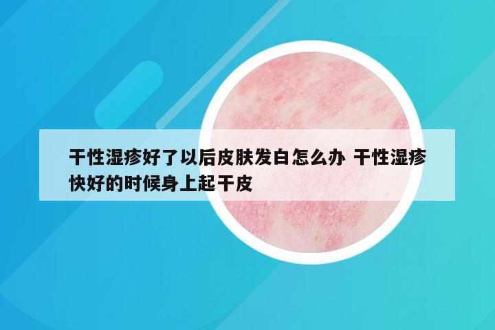 干性湿疹好了以后皮肤发白怎么办 干性湿疹快好的时候身上起干皮